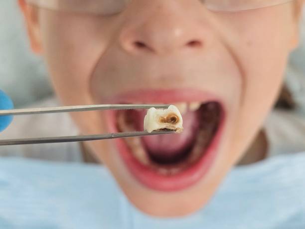 Best Urgent Tooth Repair  in Signal Mountain, TN